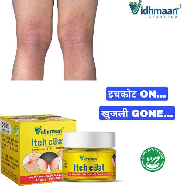 vidhmaan ayurveda Ayurvedic itchcoat Malam Ointment – Complete Itch Control