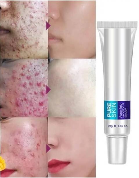 Luzimaisa Pigmentation Cream Acne Scar Removal Cream