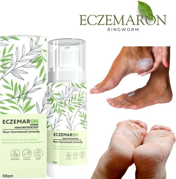 Eczemaron Ringworm Harbal Foot Heel Crack Repair Cream Pack - 1