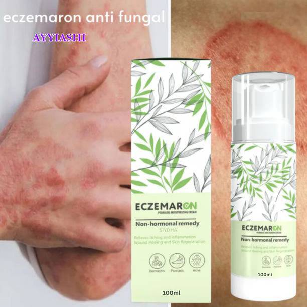 AYYIASHI Eczemaron Skin Soothing Cream For Itching And Fungal Issues