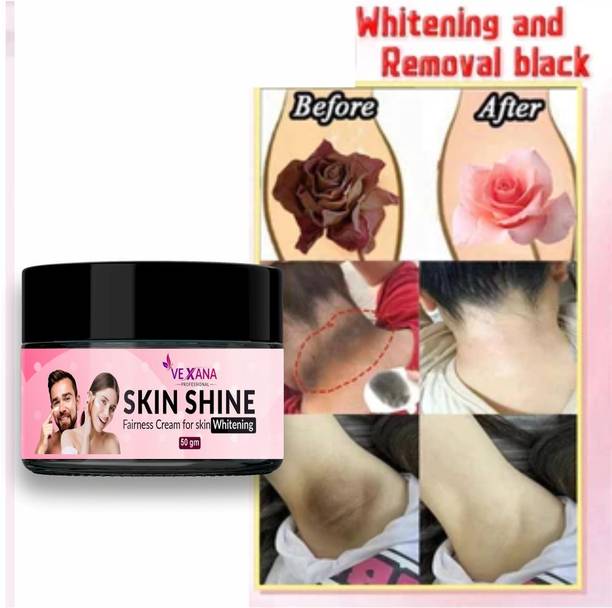 vexana Whiting Cream for Dark Spots, Brightening Bikini Area ,Underarms
