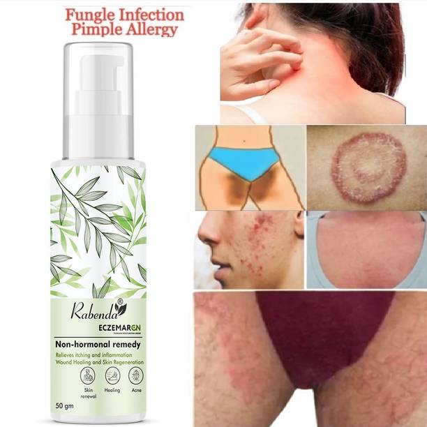 RABENDA Herbal Eczemaron ItchCoat-Eczema Cream Pack Of 1 (50 ml)
