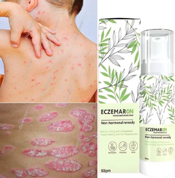 buewey Cream for Anti-Fungal Infection ,Itching & Skin Recovery