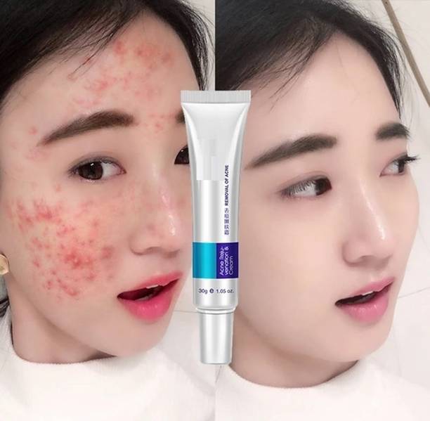 luzimaisa Anti Pigmentation Cream Skin care Remove Acn
