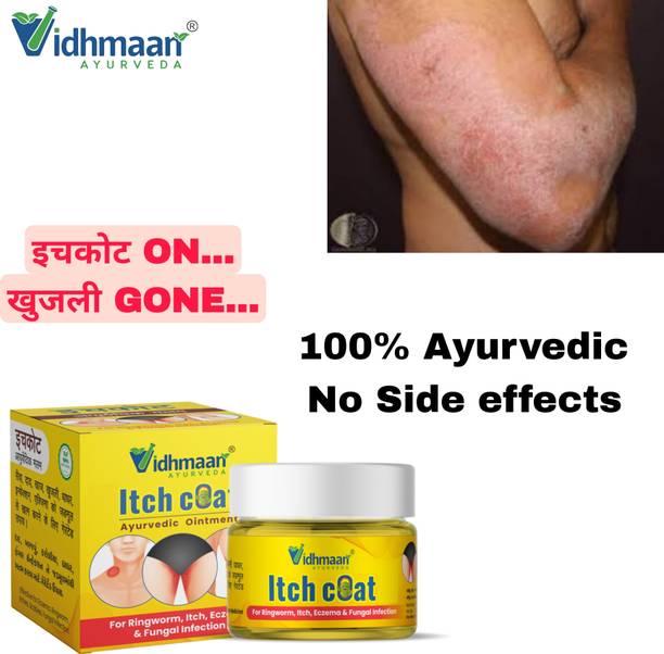 vidhmaan ayurveda itchcoat Anti‑Fungal Ointment Malam – Ringworm & Itching Solution