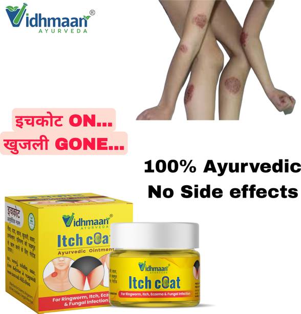 vidhmaan ayurveda itchcoat Anti‑Fungal Cream Malam – Itch & Eczema Treatment