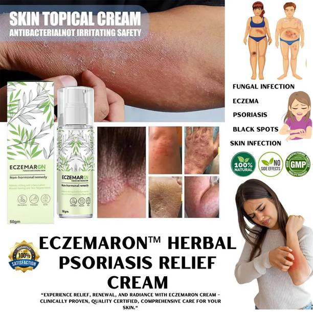 panthi Eczemaron Ayurvedic Anti fungal Cream for Ringworm,Eczema & Fungal Infection