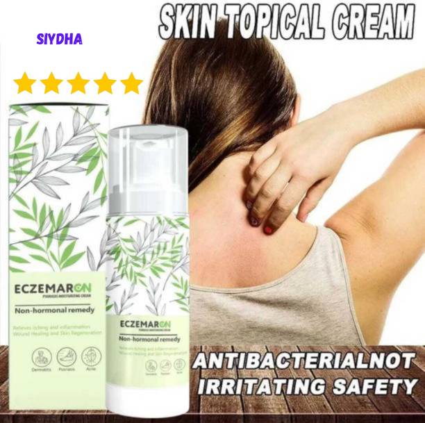 SIYDHA Advanced Eczemaron Anti Fungal Cream For Stubborn Infections