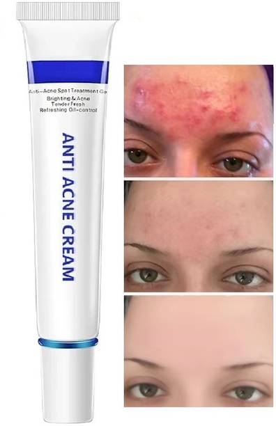 manasona Dark Spot Remover Cream, Pimple Marks, Acne Scar, Pigmentation