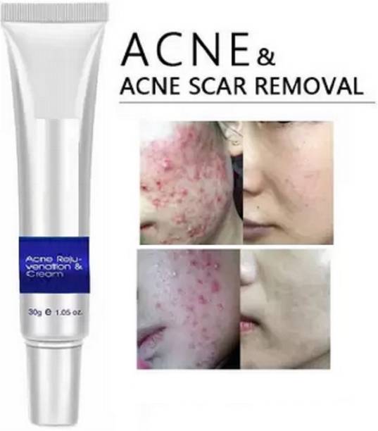 REIMICHI Spot Reduction Cream Acne Spot Corrector