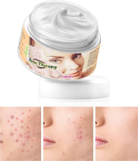 MYEONG Natural Dark Spot Remover Cream Blemish Removal,Acne Scar