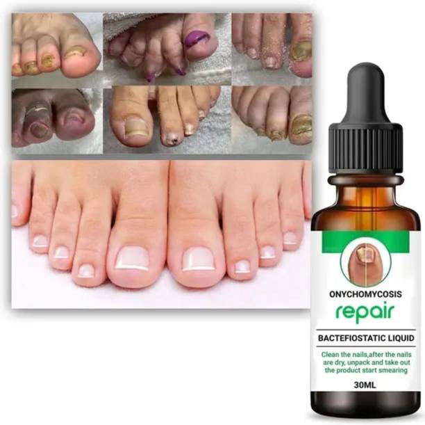 COSMIVA Nail Repair Treatment Foot Removal Toe Infection Liquid for nails Clear
