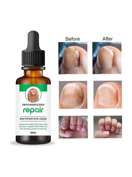 PANARO Nail Serum - Boost Nail Growth, Strong and Repair Nails | Cutical Care clear