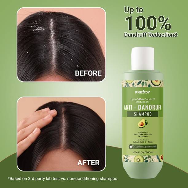 FREDDY Anti-Dandruff Shampoo - Strengthens Hair with Salicylic Acid & Biotin