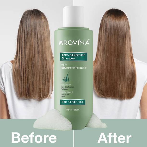 Arovina Anti Dandruff Shampoo 30 with Salicylic Acid & Biotin for Women & Men