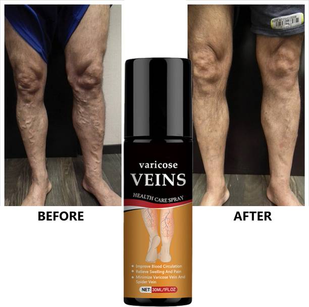 Marengo Foot & Heel Pain Relief Spray – With Soothing Boswellia and Essential Oils Spray