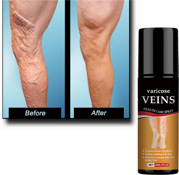 Marengo Instant Relief Foot & Heel Spray – Herbal Boswellia Extract for Pain & Swelling Spray
