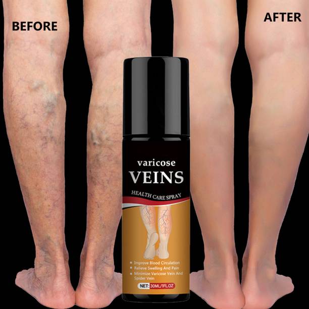 vvqvv Herbal Varicose Spray – Improves Vein Health & Reduces Leg Fatigue Spray