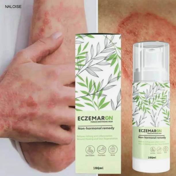 NALOISE Anti Itch Cream For Eczema | Skin Nourishment Long Lasting Hydration Cream