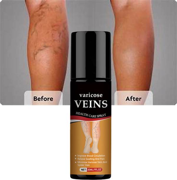 Marengo Boswellia Herbal Foot & Heel Pain Relief Spray – All-Natural Soothing Solution Spray