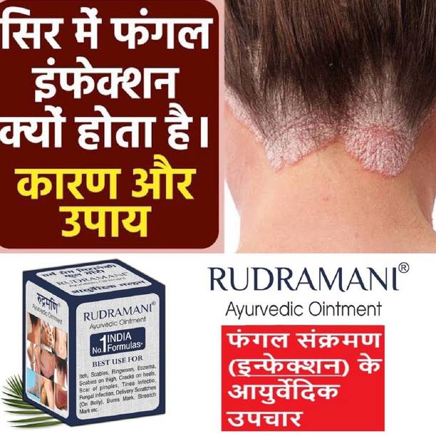 Rudramani Ayurvedic Anti fungal Malam itching,Ringworm,Eczema,Skin Infection,Skin Tretment