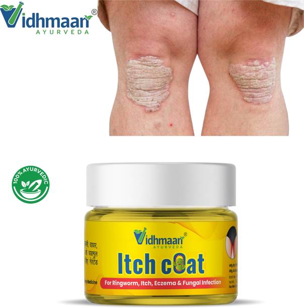 vidhmaan ayurveda Ayurvedic itchcoat for Ringworm, itching, Eczema & Fungal Infection Anti Fungal Cream