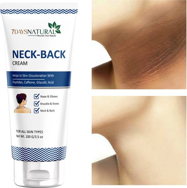 7days natural Dark Neck Back Whitening Cream For Dark Neck Ankles Knuckles Elbows Underarm