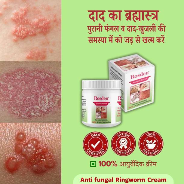 Rosden Ayurvedic Skin Malam 25g – Daad, Khaj, Fungal Care