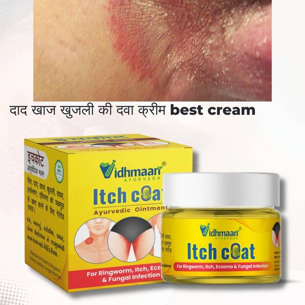 vidhmaan ayurveda itchcoat ayurvedic dad khujali cream antifungal,ringworm itching ke liye