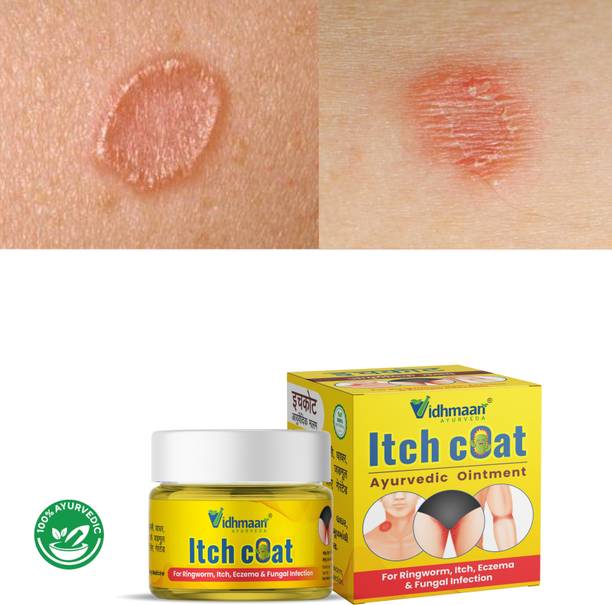 vidhmaan ayurveda itch coat Fungal,itching Cream For Skin Khaj Khujli Itch Coat fungal Men & Women
