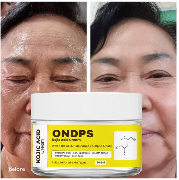 ONDPS Kojic Acid Face Cream for Pigmentation, Tan Removal & Dark Spot Correction WX1
