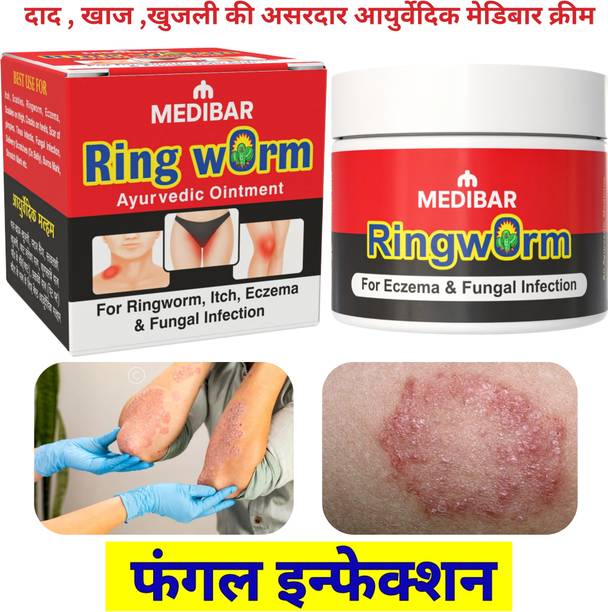 medibar Ayurvedic Skin Ointment 30g for Ringworm & Fungal Infection (Pack -1 )