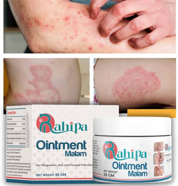RAHIPA Daad Ka Brahmastra - Ringworm, Itch & Skin Fungal Infection Cream | Fast-Acting Formula | Effective Relief |Natural Ayurvedic...00