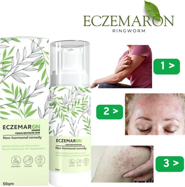 Eczemaron Ringworm Ayurvedic -Anti fungal Malam - for Ringworm, Eczema & Fungal Infection