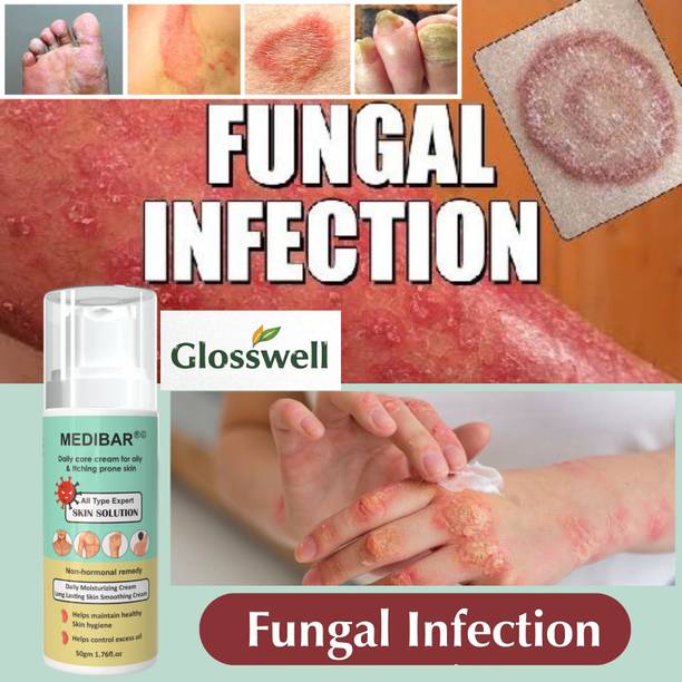 glosswell Daily Care Cream for Oily & Itching Prone Skin | Skin Hygiene Support