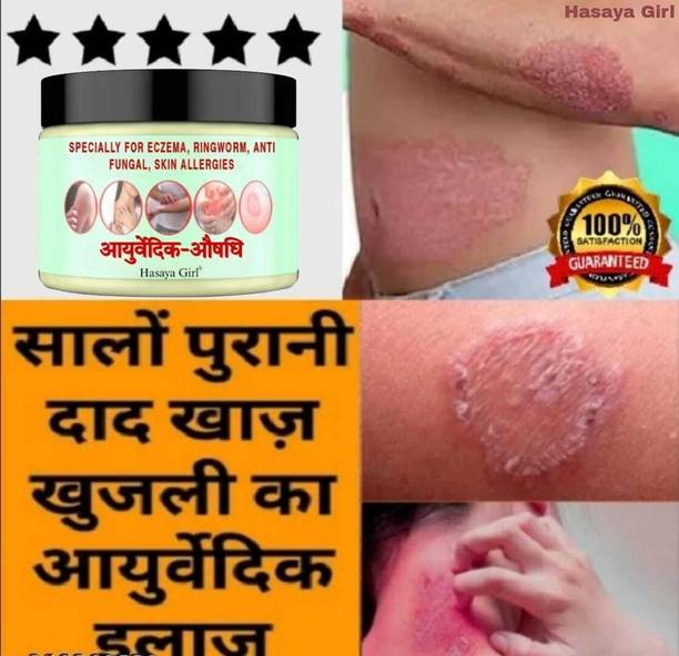 HGHASAYAGIRL Ayurvedic Anti fungal itchcoat Malam for Ringworm, itching, Fungal Infection & Eczema result in 7 days