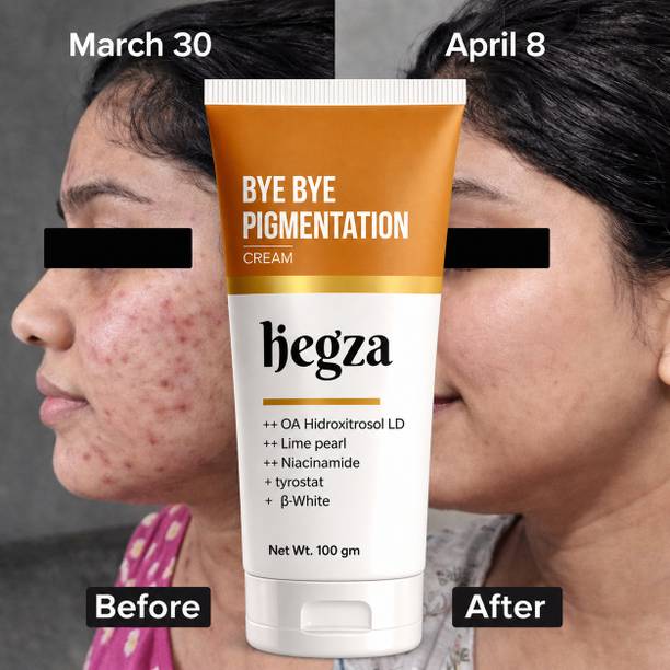 Hegza Anti Pigmentation Cream | Remove Dark Spots, Tanning & Melasma | Glowing Skin | Acne Marks | Skin Whitening & Brightening |