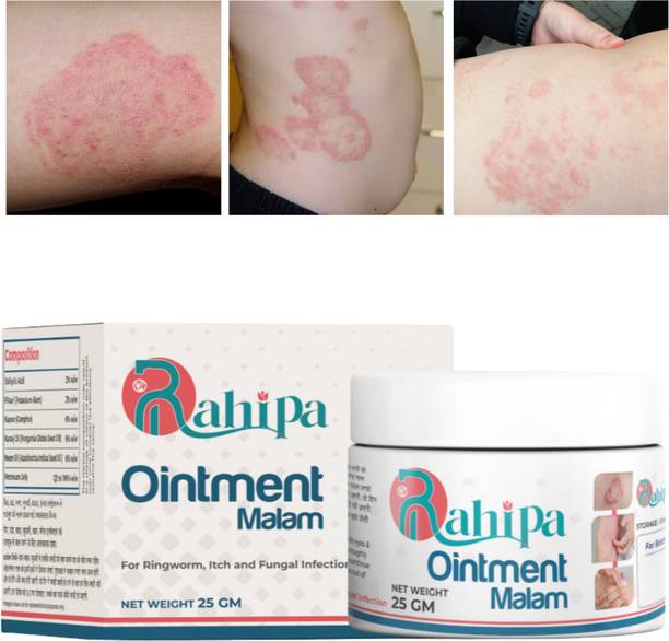 RAHIPA Fungal Malam: Complete Relief from Ringworm, Eczema & Itching..00