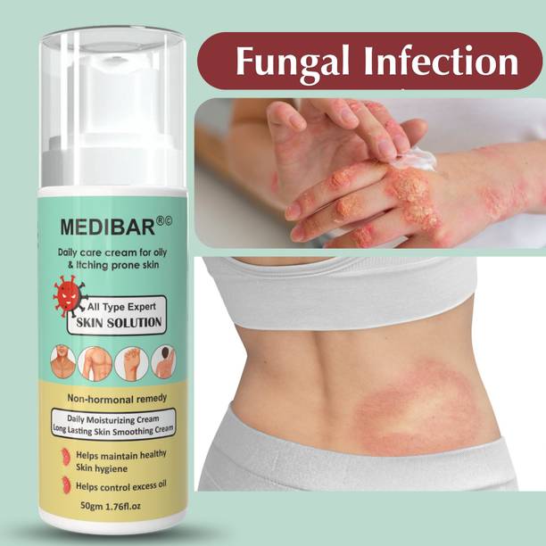 medibar AntiFungal Cream For Itching, Ringworm, Dad Khaj Khujali, Skin Treatment