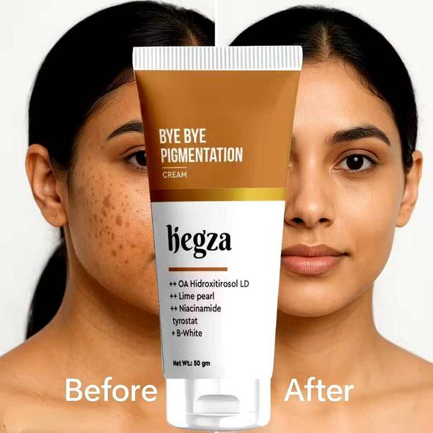 Hegza PigmentBye Advanced Glow Cream – Anti-Pigmentation & Dark Spot Corrector for Even Skin Tone & Radiant Glow