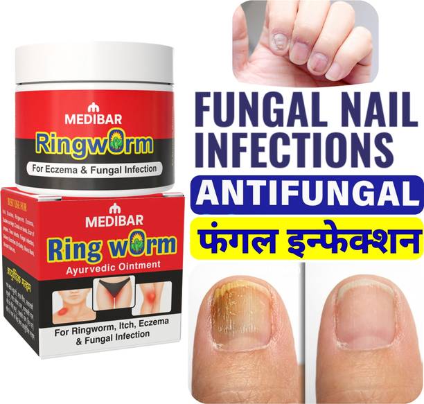 medibar Nail fungal infection: Causes, treatment, and symptoms ,Fungal Cream Nail Infection (Pack -1)