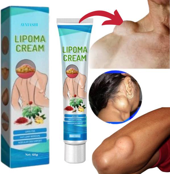 SIYDHA Lipoma Balm Cream Herbal Daily Care For Fat Lumps - Men And Women