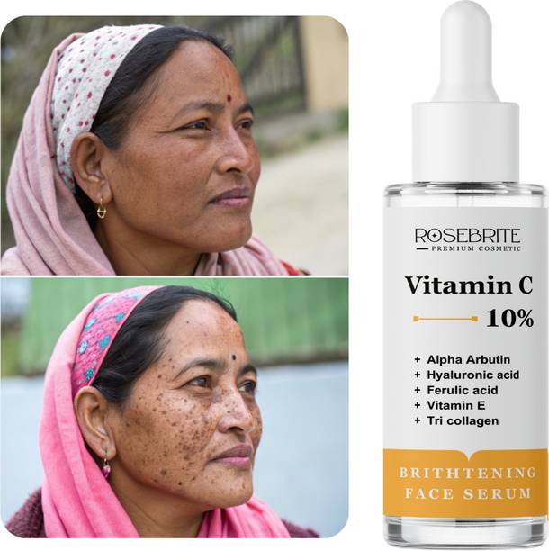 RoseBrite Barrier Repair & Glow Serum – Vitamin C Boosts Skin Strength, Radiance & Hydration Levels