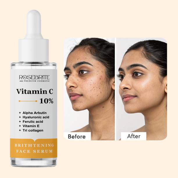 RoseBrite Best Dark Spot Remover Vitamin C Serum – Reduces Hyperpigmentation, Acne Scars & UV Damage for Brighter Skin