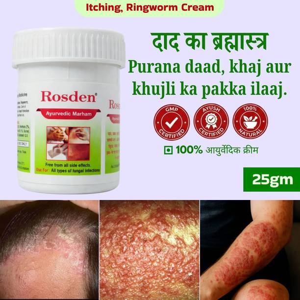 Rosden Herbal Ayurvedic Malam 25g – Daad Khaj Care