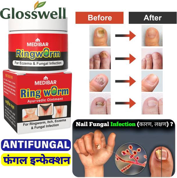 glosswell Ayurvedic Ringworm Cream for Itching, Fungal Infection Cream