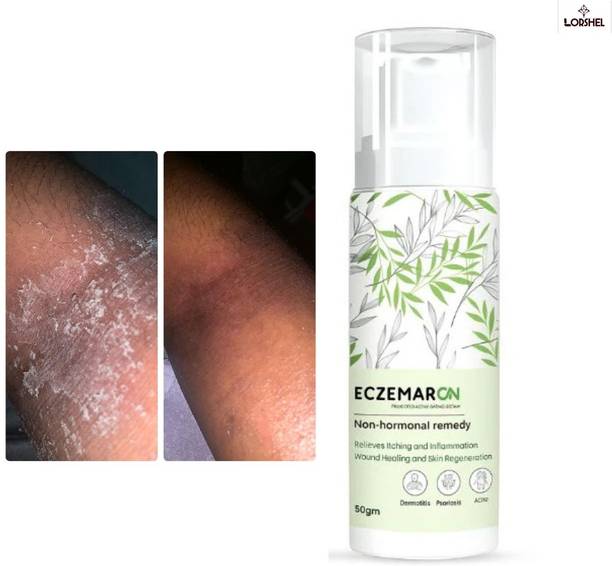 LORSHEL Eczemaron Fungal Cream - Advanced Treatment with Gentle on Skin