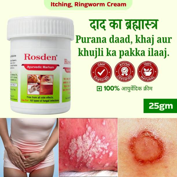 Rosden Antifungal Daad Khaj Cream 25g – Ayurvedic Formula