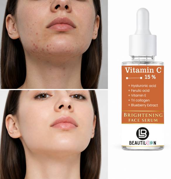 beautiloon Vitamin C Face Serum for Women and Men with 15% Vitamin C Hyaluronic Acid Vitamin E Ferulic Acid for Skin Whitening Brightening Glow Boosting Dark Spot Removal Acne Marks Pigmentation Reduction Wrinkle Repair Skin Tightening and Healthy Smooth Skin 30ml