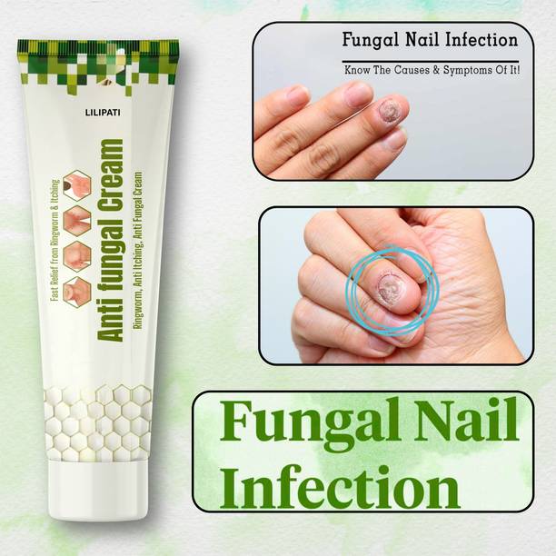 LILIPATI Advanced Antifungal Nail Cream | Nail Infection Treatment & Damaged Nail Repair Solution
